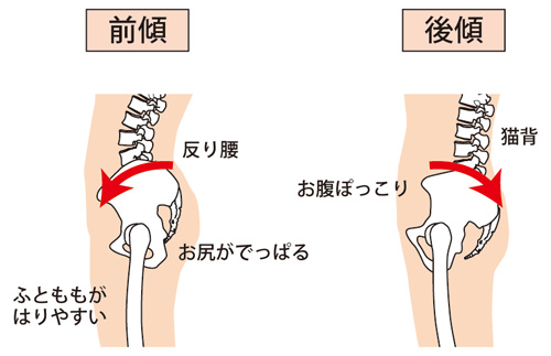 骨盤の前傾後傾イラスト