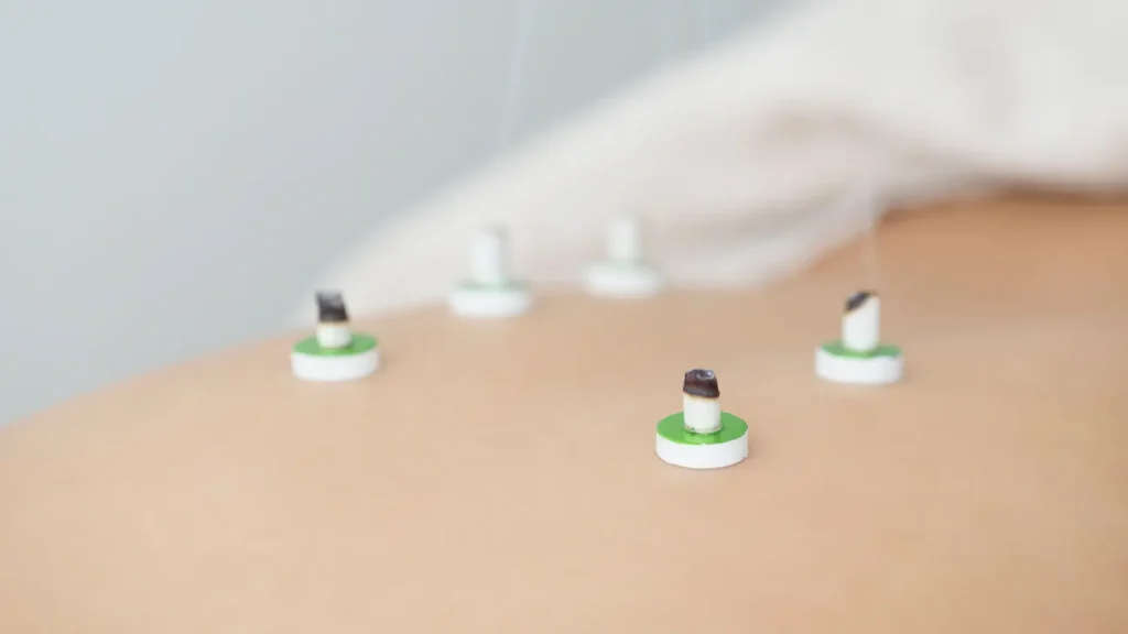 逆子にはお灸が効果的です!