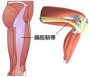 腸脛靭帯イラスト