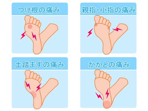 足裏の痛みの図解