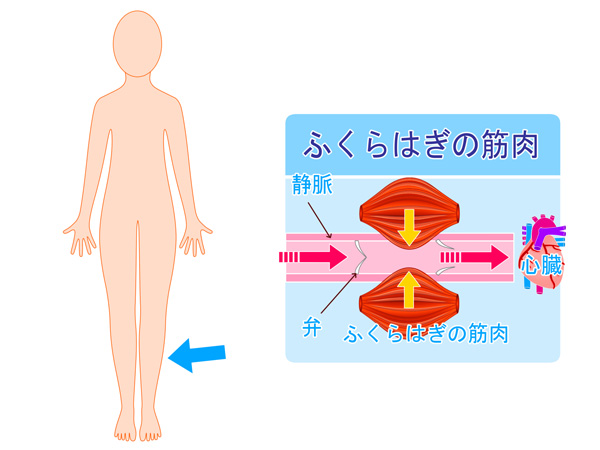 むくみの原因図解イラスト