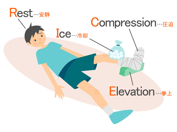 捻挫の治療の大原則はRICE（ライス）図