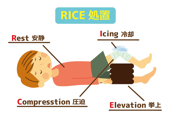 RICE処置イラスト