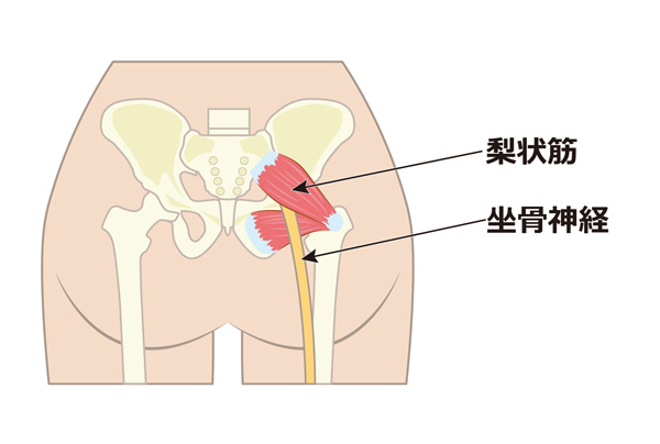 梨状筋イラスト