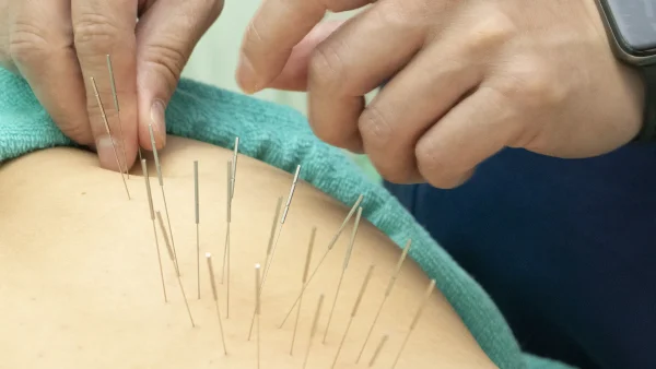 自律神経が乱れると体はこう変わる。ルート治療で“根本から整える”理由