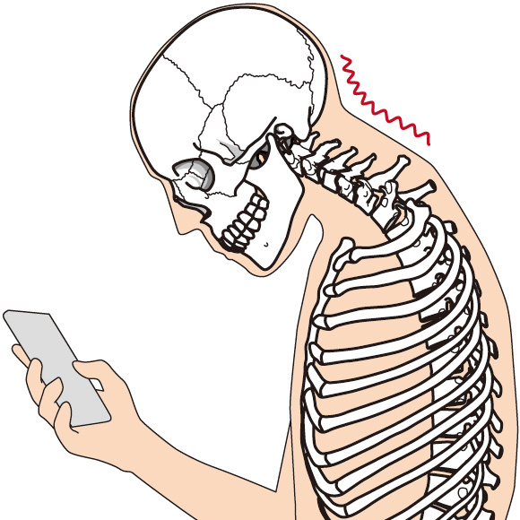 スマホを見て猫背になる図解