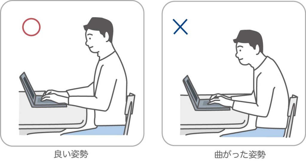 デスクワーク
姿勢不良
姿勢比較画像
