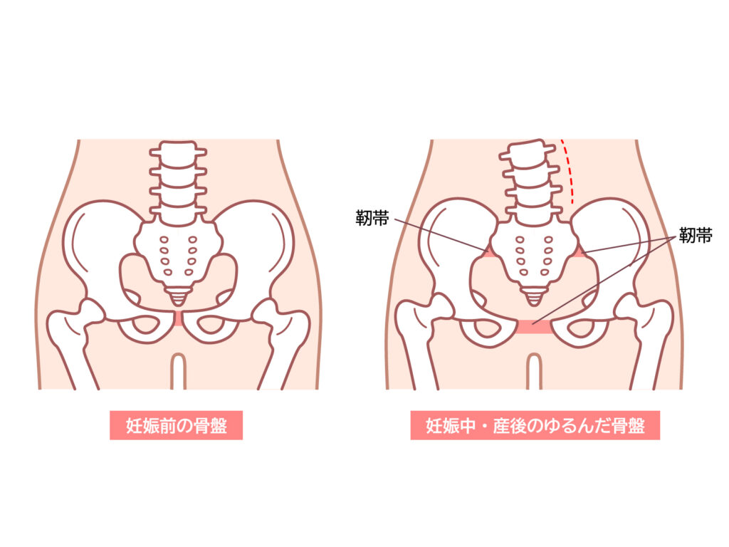 産後の骨盤画像
